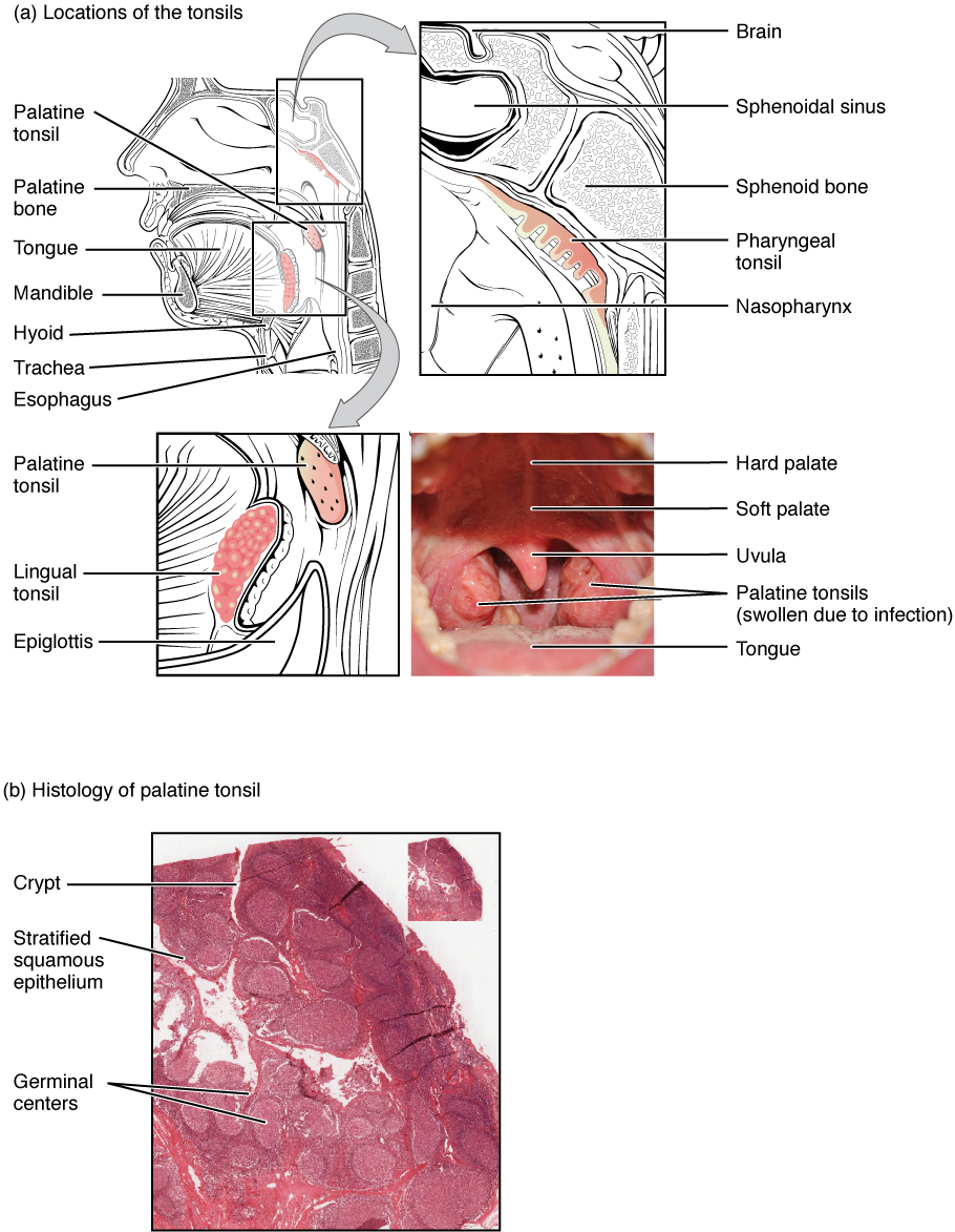 Locations of the tonsils. Image description available.