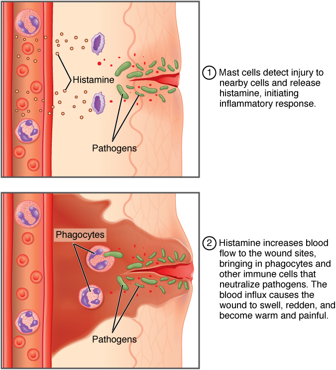 the difference in lymphatic function in health and disease state